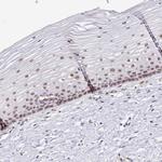 RFX1 Antibody in Immunohistochemistry (Paraffin) (IHC (P))