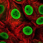 HDGF Polyclonal Antibody