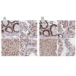 HDGF Antibody in Immunohistochemistry (IHC)