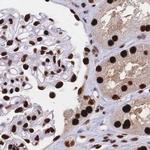 HDGF Antibody in Immunohistochemistry (IHC)