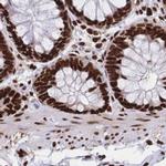 HDGF Antibody in Immunohistochemistry (IHC)