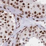 HDGF Antibody in Immunohistochemistry (IHC)
