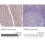 AKAP6 Polyclonal Antibody