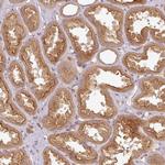 RNF31 Antibody in Immunohistochemistry (Paraffin) (IHC (P))