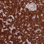 RPS9 Polyclonal Antibody