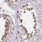 CLGN Antibody in Immunohistochemistry (Paraffin) (IHC (P))