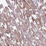 TMEM178B Antibody in Immunohistochemistry (Paraffin) (IHC (P))