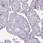 TMEM178B Antibody in Immunohistochemistry (Paraffin) (IHC (P))