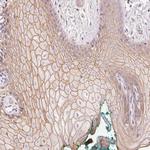 p53AIP1 Polyclonal Antibody