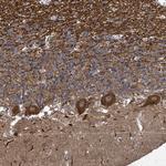 KRTAP27-1 Polyclonal Antibody