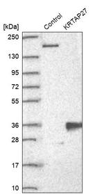 KRTAP27-1 Antibody in Western Blot (WB)