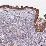 CEP78 Polyclonal Antibody