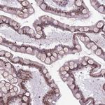 DHX32 Antibody in Immunohistochemistry (Paraffin) (IHC (P))