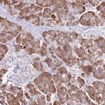 Det1 Antibody in Immunohistochemistry (Paraffin) (IHC (P))
