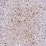 SHCBP1 Polyclonal Antibody