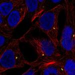 LTB Polyclonal Antibody