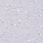 LTB Antibody in Immunohistochemistry (IHC)