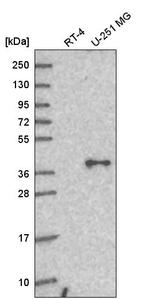 GNA11 Antibody in Western Blot (WB)