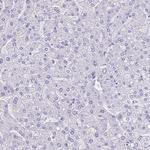 TBC1D10B Antibody in Immunohistochemistry (Paraffin) (IHC (P))