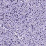 TBC1D10B Antibody in Immunohistochemistry (Paraffin) (IHC (P))