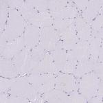 TBC1D10B Antibody in Immunohistochemistry (Paraffin) (IHC (P))