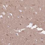 KIAA0090 Antibody in Immunohistochemistry (Paraffin) (IHC (P))