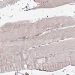 KIAA0090 Antibody in Immunohistochemistry (Paraffin) (IHC (P))