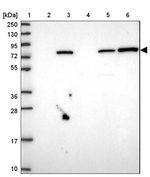 KBTBD6 Antibody in Western Blot (WB)