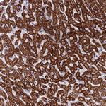 RNF222 Polyclonal Antibody