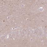 LRFN3 Polyclonal Antibody