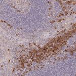 DERL2 Polyclonal Antibody
