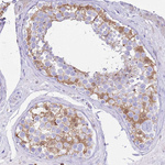 EFHD2 Antibody in Immunohistochemistry (Paraffin) (IHC (P))