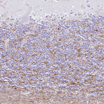 EFHD2 Antibody in Immunohistochemistry (Paraffin) (IHC (P))