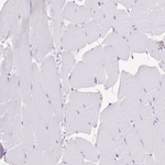 EFHD2 Antibody in Immunohistochemistry (Paraffin) (IHC (P))