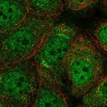 RFX2 Polyclonal Antibody