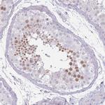 RFX2 Antibody in Immunohistochemistry (Paraffin) (IHC (P))