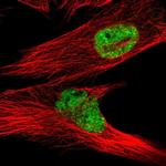 LPPR2 Polyclonal Antibody