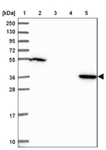 LPPR2 Antibody in Western Blot (WB)
