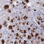 CLEC18B Polyclonal Antibody