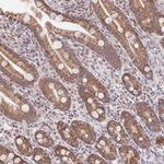 TIMM13 Antibody in Immunohistochemistry (Paraffin) (IHC (P))