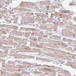 TIMM13 Antibody in Immunohistochemistry (Paraffin) (IHC (P))