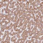 TIMM13 Antibody in Immunohistochemistry (Paraffin) (IHC (P))