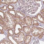 PLEKHJ1 Antibody in Immunohistochemistry (Paraffin) (IHC (P))