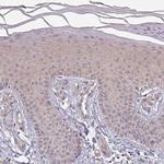 PLEKHJ1 Antibody in Immunohistochemistry (Paraffin) (IHC (P))