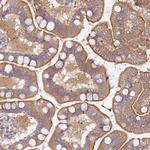 PLEKHJ1 Antibody in Immunohistochemistry (Paraffin) (IHC (P))