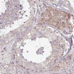 PLEKHJ1 Antibody in Immunohistochemistry (Paraffin) (IHC (P))