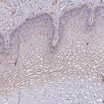 SMYD5 Polyclonal Antibody