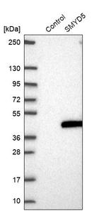 SMYD5 Antibody in Western Blot (WB)