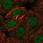 ZBTB24 Polyclonal Antibody