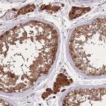 ZNF639 Antibody in Immunohistochemistry (IHC)